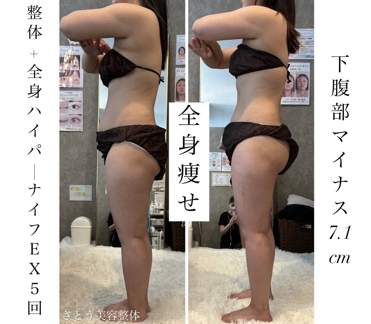 フォト|さとう美容整体 町田店|ホットペッパービューティー フォト|さとう美容整体 町田店|ホットペッパービューティー