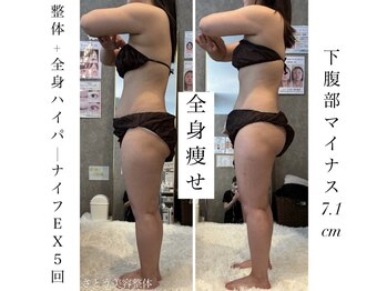 さとう美容整体 町田店/全身痩せ!姿勢改善+脂肪ケア