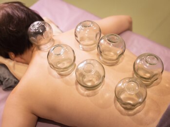 東洋リラックス苑/カッピング