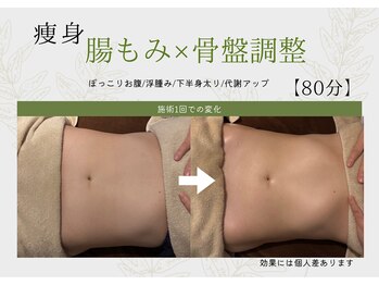 シュシュ 岸和田(chouchou)/施術例/腸もみ×骨盤調整