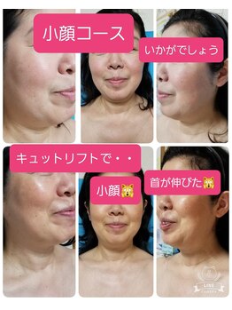 キレイとケンコウの応援サロン杉山/リフティングコース