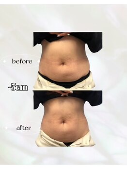 カリス(charis)/Before &After 