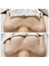 美人バスト リグラス(ReGrous)/バストアップbefore after