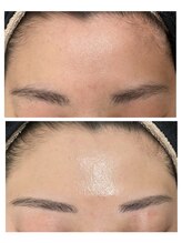 ブリリアンス(BRILLIANCE)/コースメニューでより美肌に♪