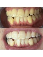 ライトビューティー 池袋店(LightBeauty)/症例写真