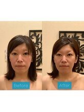 アジール 長岡リバーサイド千秋店(agir)/Before/After画像