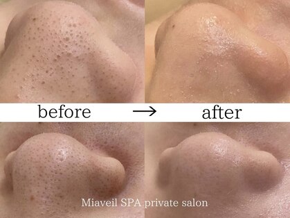 ミアヴェール(Miaveil)の写真