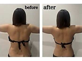 テンディ(TenD.)/サイズダウン