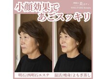 ヨサパーク レナータ(YOSA PARK Renata)/水素酸素吸入30分の変化♪