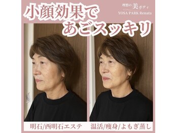 ヨサパーク レナータ(YOSA PARK Renata)/水素酸素吸入30分の変化♪