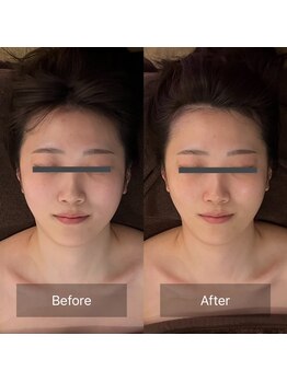 グレースフィオーレ 高槻店(gracefiore)/お客様ビフォーアフター