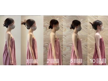 ロココ 豊田店(Rococo)/ビフォーアフター