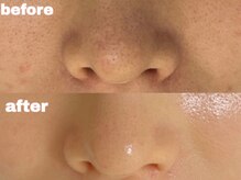 サゥオルサロン(sawalsalon)/セラピール症例【美肌/艶肌】