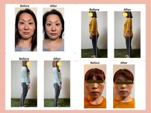 フェルナ(FERNA)の雰囲気（Before/Afterはフォトギャラリーをご覧ください。）