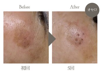 ビューティーリバース 湘南台店/★劇的ビフォーアフター★