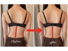 美バストアルファ(美bust α)/【バストアップ】歪みも改善