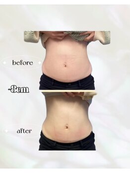 カリス(charis)/Before &After 