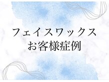 シン(sin)/マツヤニワックス