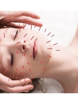 いちかわレディース鍼灸院/【美肌・小顔・しわ改善】美容鍼