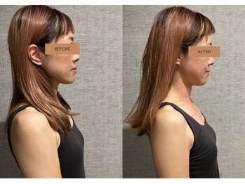 メグムサロン(Megumu Salon)/空ルート/肩こり腰痛/マッサージ