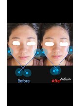 美容矯正サロン レレポノ(LELEPONO)/左右差改善