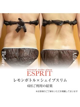 エスプリ 新宿店/レモンボトル×シェイプスリム