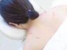 【全員】首肩こり腰痛改善◎全身鍼灸＋ボディオイル矯正90分¥16,800