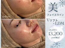 アマテラススキンラウンジ(Amatelas SKIN LOUNGE)