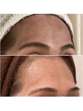 アンナチュラル 錦糸町店(ennatural)/最新プラズマ★即効性・持続性◎