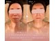 イロカ(Iroka)の写真