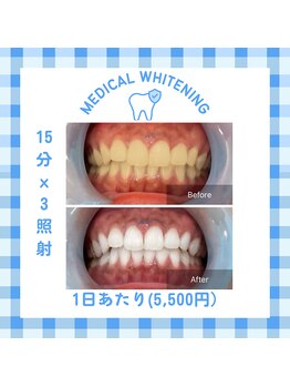 ベルプラス 新大阪(Belle plus)/15分×3照射ホワイトニング