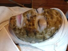 アンフルール(en fleur)/ハーブピーリング