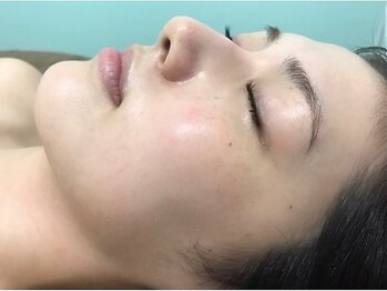 エルサ(Elsa)の写真/【美肌育成】当店人気『陶肌トリートメント』で毛穴大洗浄♪肌質を根本から改善し毛穴レスのうる艶美肌へ★