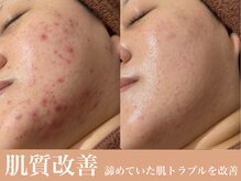 ミュー(mieux)の雰囲気（今の肌に何が必要かカウンセリングし結果重視の肌質改善）