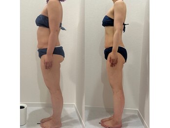 ヴィナーレ(VINARE)/本気deダイエット/30代のお客様