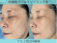 リメイク 広尾(REMAKE)/