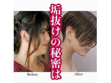 オーラ 美容サロン(AURA)の雰囲気（小顔矯正☆フェイスライン・むくみ・口ゴボ・肩コリ・頭痛にも♪）