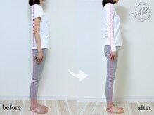 エーアール(AR)/【Before/After】4回目