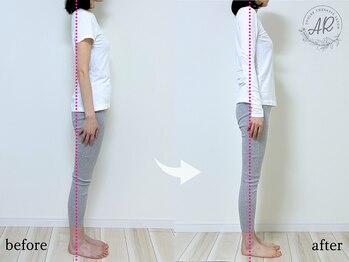 エーアール(AR)/【Before/After】4回目