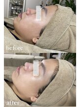 ミーミドットアイ(Mi-mi.i)/艶つやツヤ(〃ω〃)