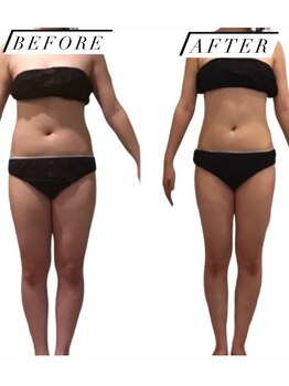 ティパニボーテ(Tipani Beaute')/ハイパーReborn痩身