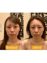 アジール 長岡リバーサイド千秋店(agir)/Before/After画像