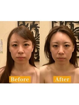 アジール 長岡リバーサイド千秋店(agir)/Before/After画像