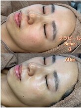 ジナ ビューティ(GINA BEAUTY)/ララピール（韓国肌管理）