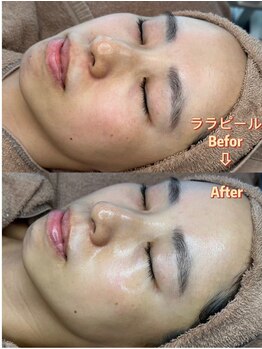 ジナ ビューティ(GINA BEAUTY)/ララピール（韓国肌管理）