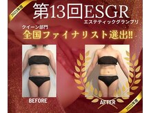 【痩身体験コース】エステグランプリで全国上位になったメニューをご体験頂けます