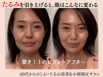 エンジェルエッグの写真