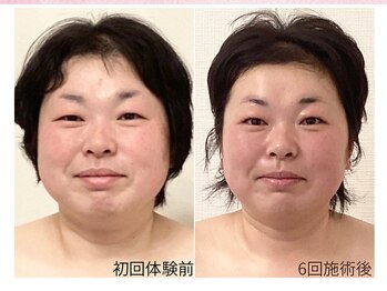 幸せ甦顔/目元パッチリ小顔に