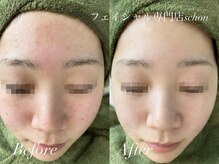 シェーン(Schon)の雰囲気（即効性や結果重視の本格肌質ケア◎）