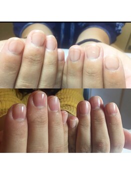 シャルリエール(Chaxrier)/自爪育成